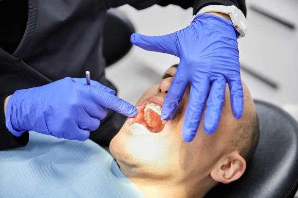 Best Emergency Gum Treatment in Countryside, VA